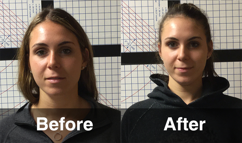 Before and after Rolf Structural Integration with Jim Arkison Before and after Rolf Structural Integration with Jim Arkison